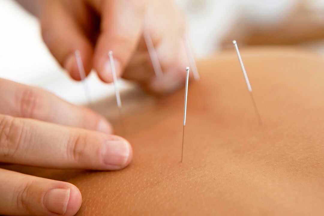 Akupunktur zur Potenzsteigerung