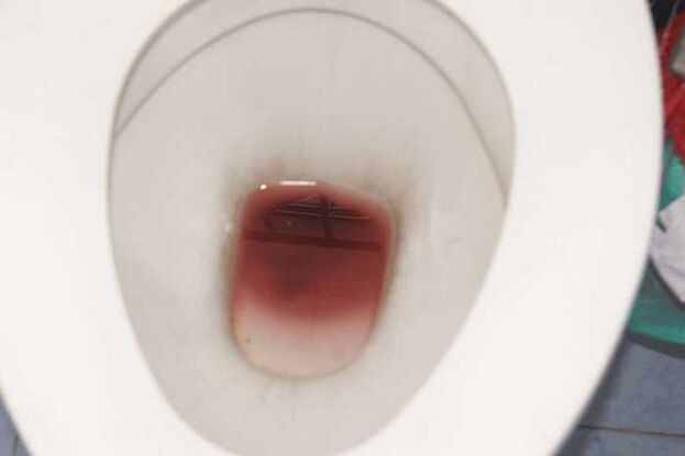 Schmierblutungen bei Männern, wenn sie erregt sind